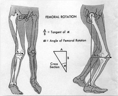 Image of Sutherland and Hagy's derivation of femoral rotation